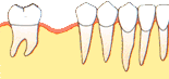 Ｓｔｅｐ４図１